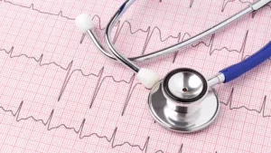 Angled overhead view of a stethoscope lying on an EKG readout printed on graph paper
